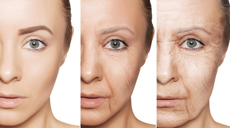 Sinais de envelhecimento da pele